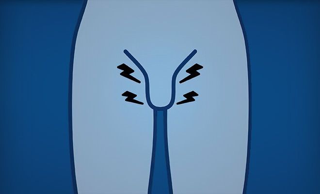 Shockwave Therapy for ED diagram