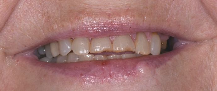 Case 3 before procedure