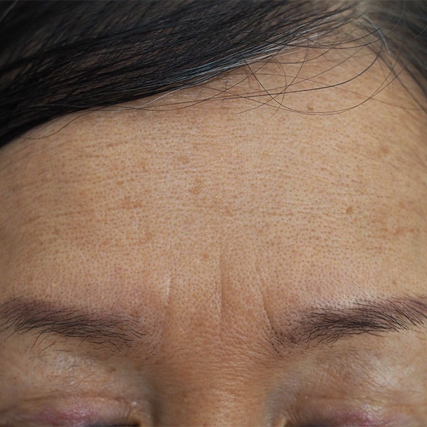 Close-up of fine lines