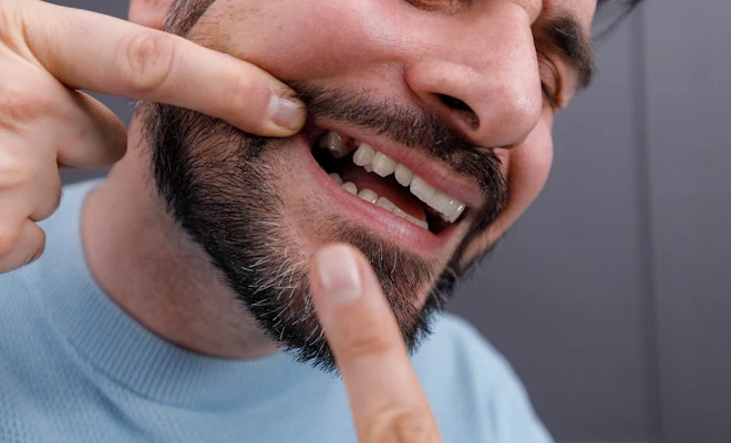 Man with a missing tooth