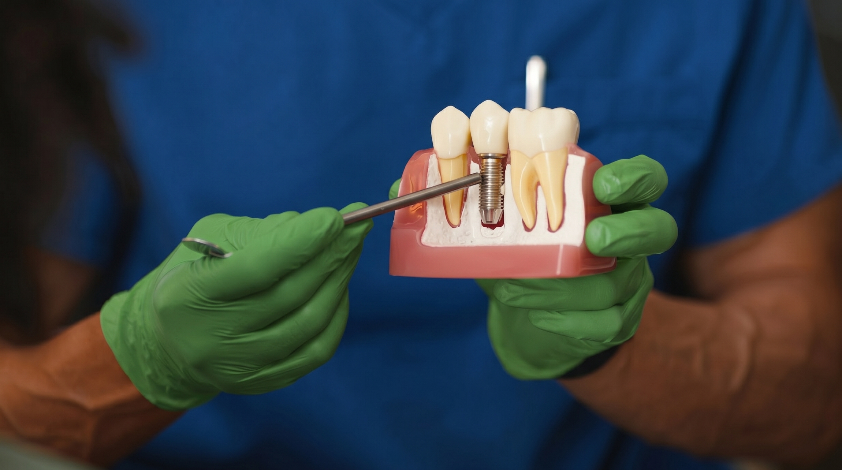 Dentist pointing to a dental implant model