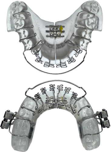 Vivos oral appliance