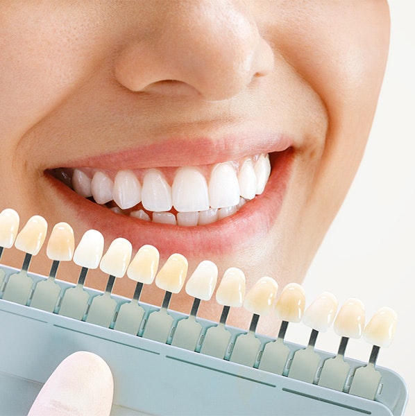 Shade guide next to teeth