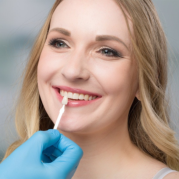 Woman comparing veneer shade