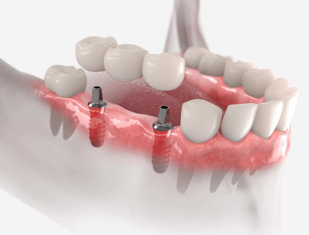 Three Ways Teeth Straightening Improves Your Oral Health - Sonoran Desert  Dentistry Scottsdale Arizona