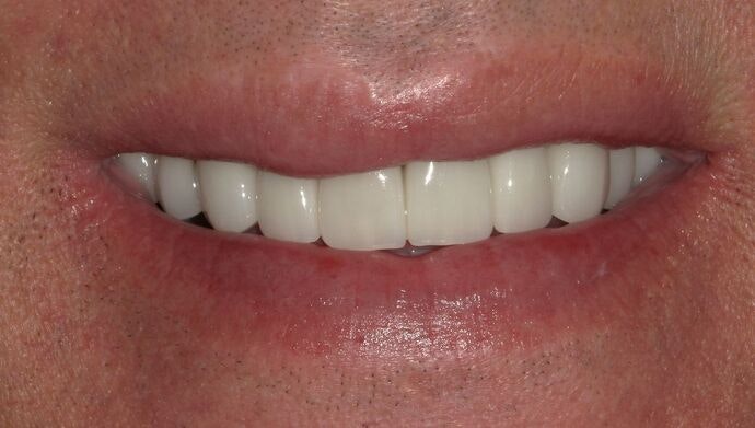 healthy-looking smile