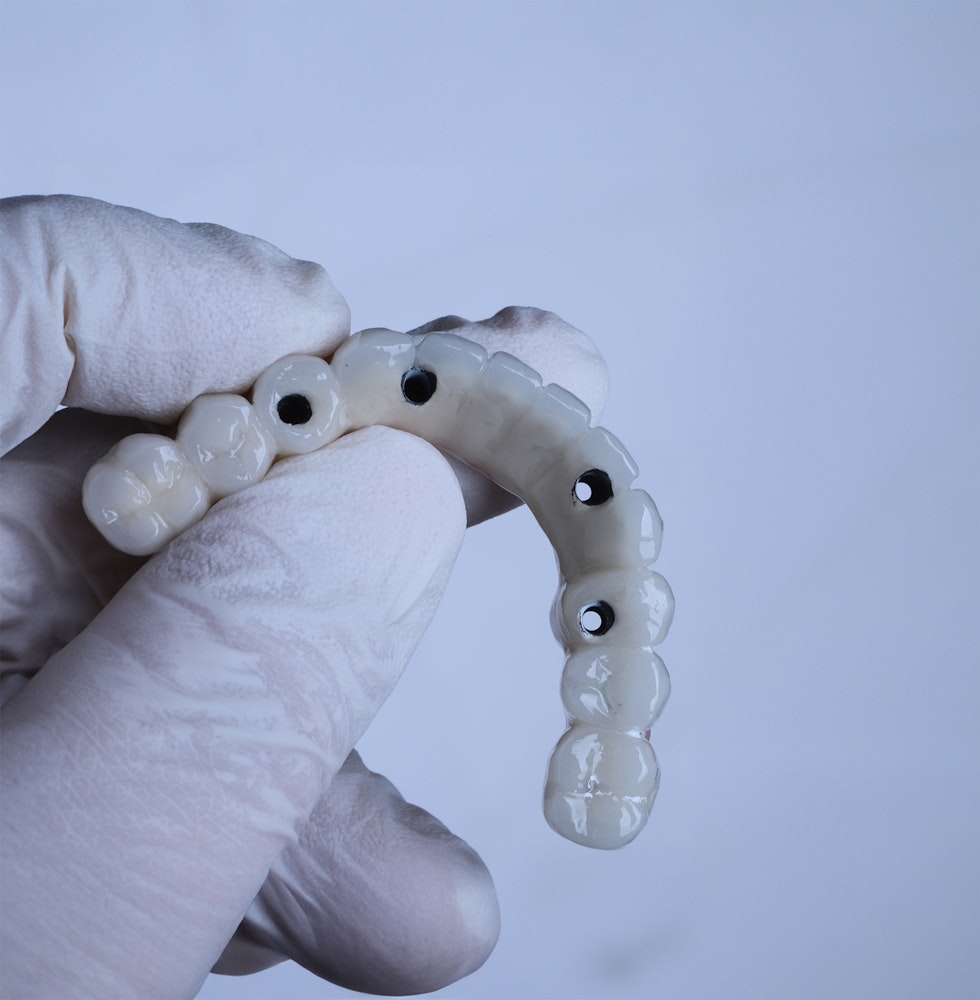 gloved hand holding all-on-4 denture