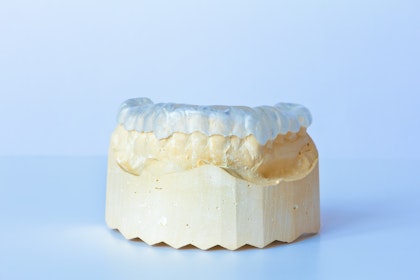 TMJ mouth guard on a dental model