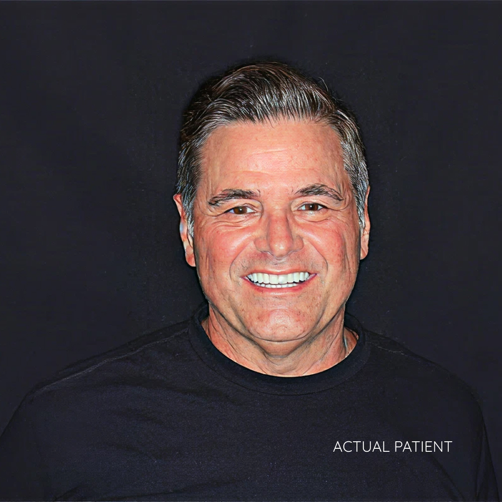 Actual crowns patient