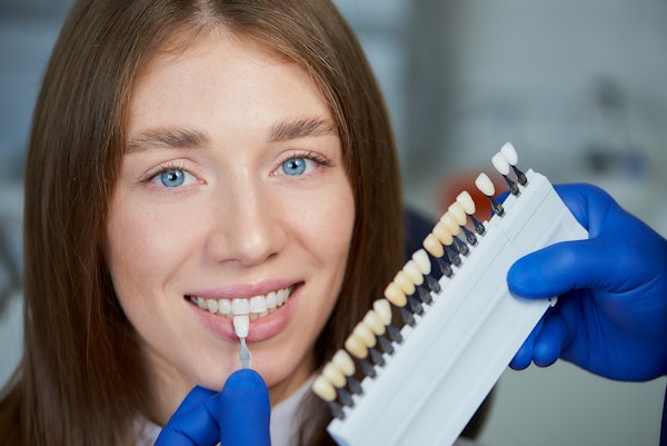 Woman getting shade matched for veneers