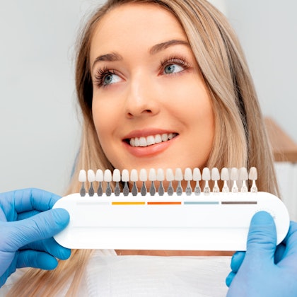 Woman getting shade matched for veneers