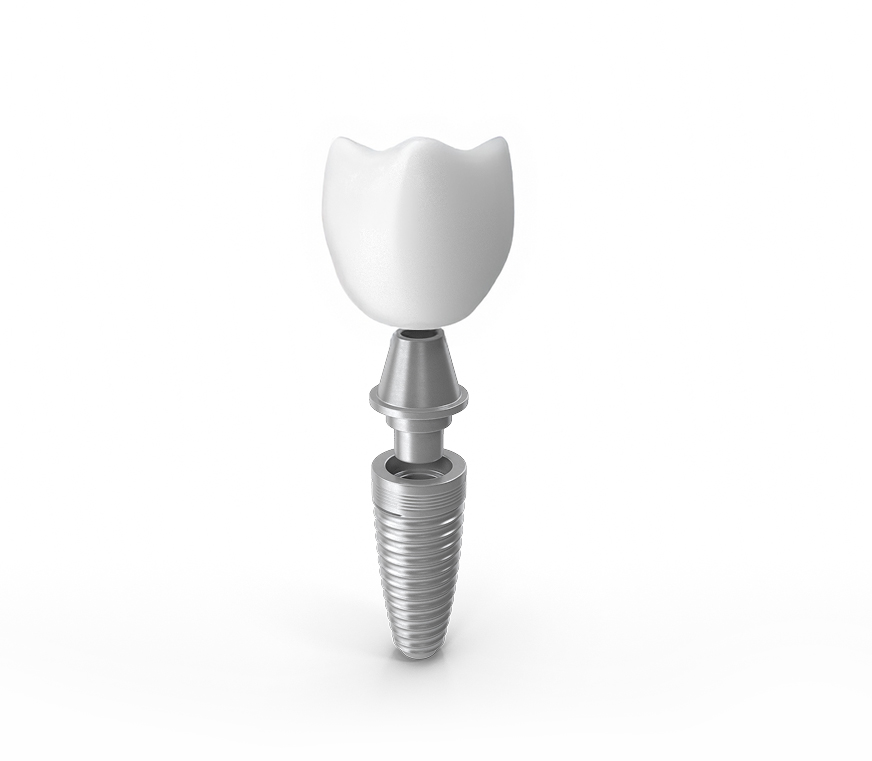 Implant crown