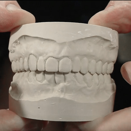 Model of teeth