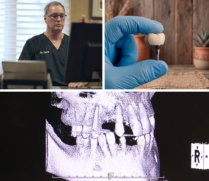 Dr. Casagrande, an implant crown, and dental x-rays