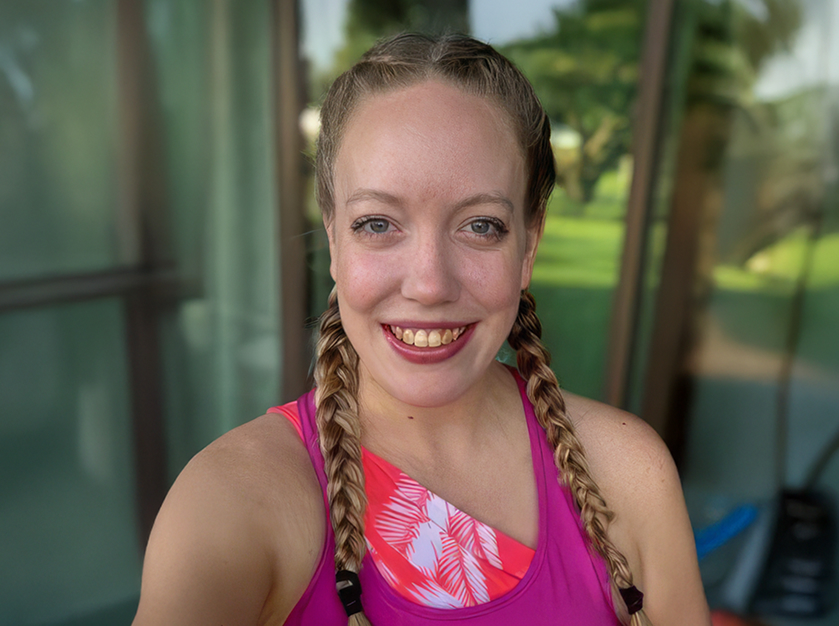 Before full mouth reconstruction