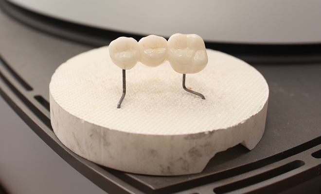 dental bridge on a stand