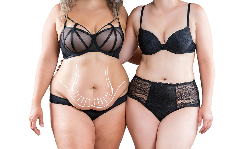 women in black underwear