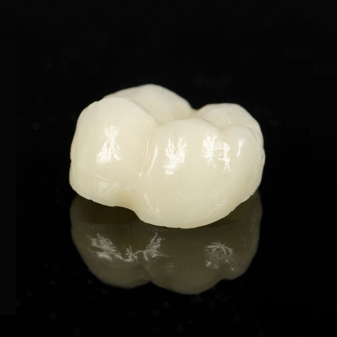Dental Crowns