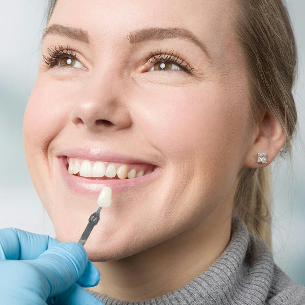 Veneer being matched to a woman's smile
