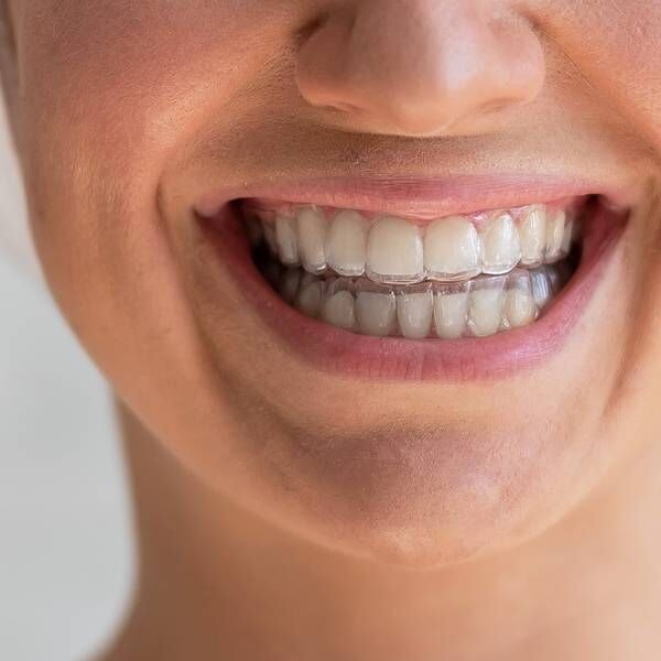 patient wearing Invisalign