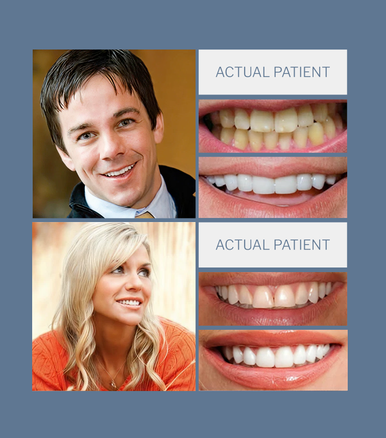 two patient before and afters