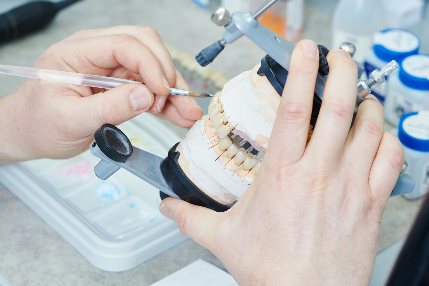 Denture restoration