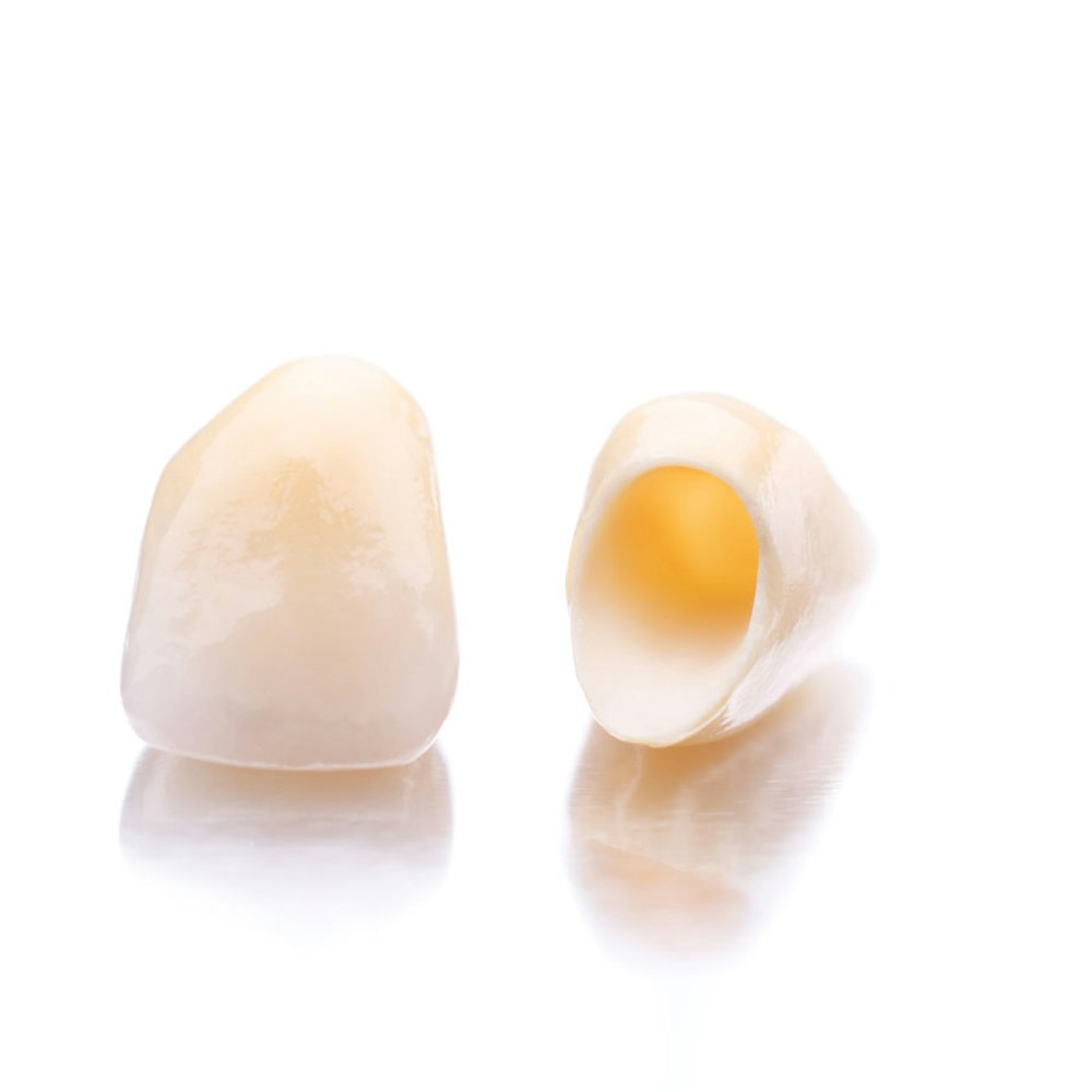 dental crowns