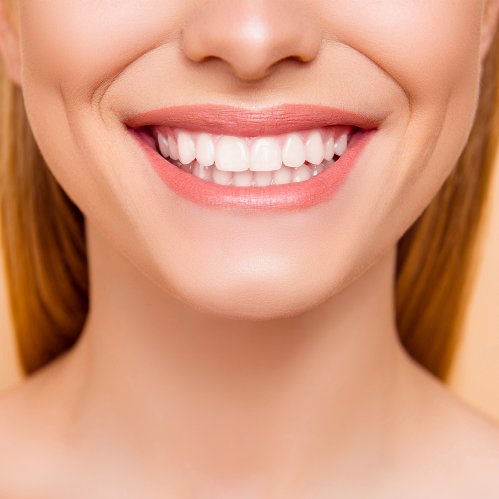 a woman's smiling mouth, showing teeth