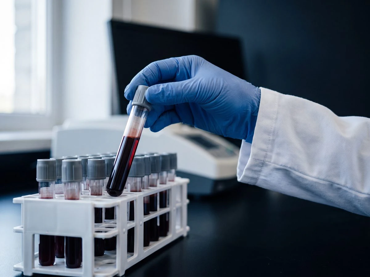 Blood tests