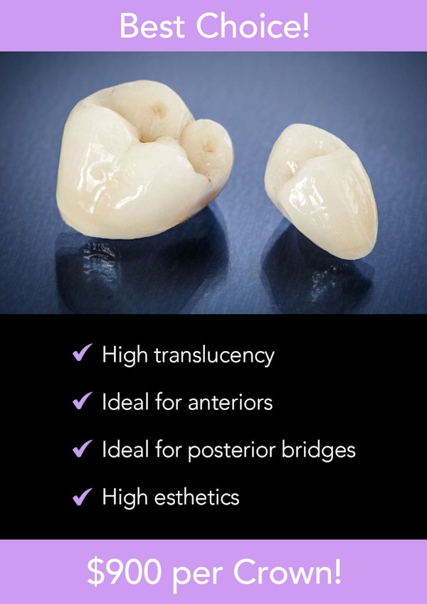 $900 crowns