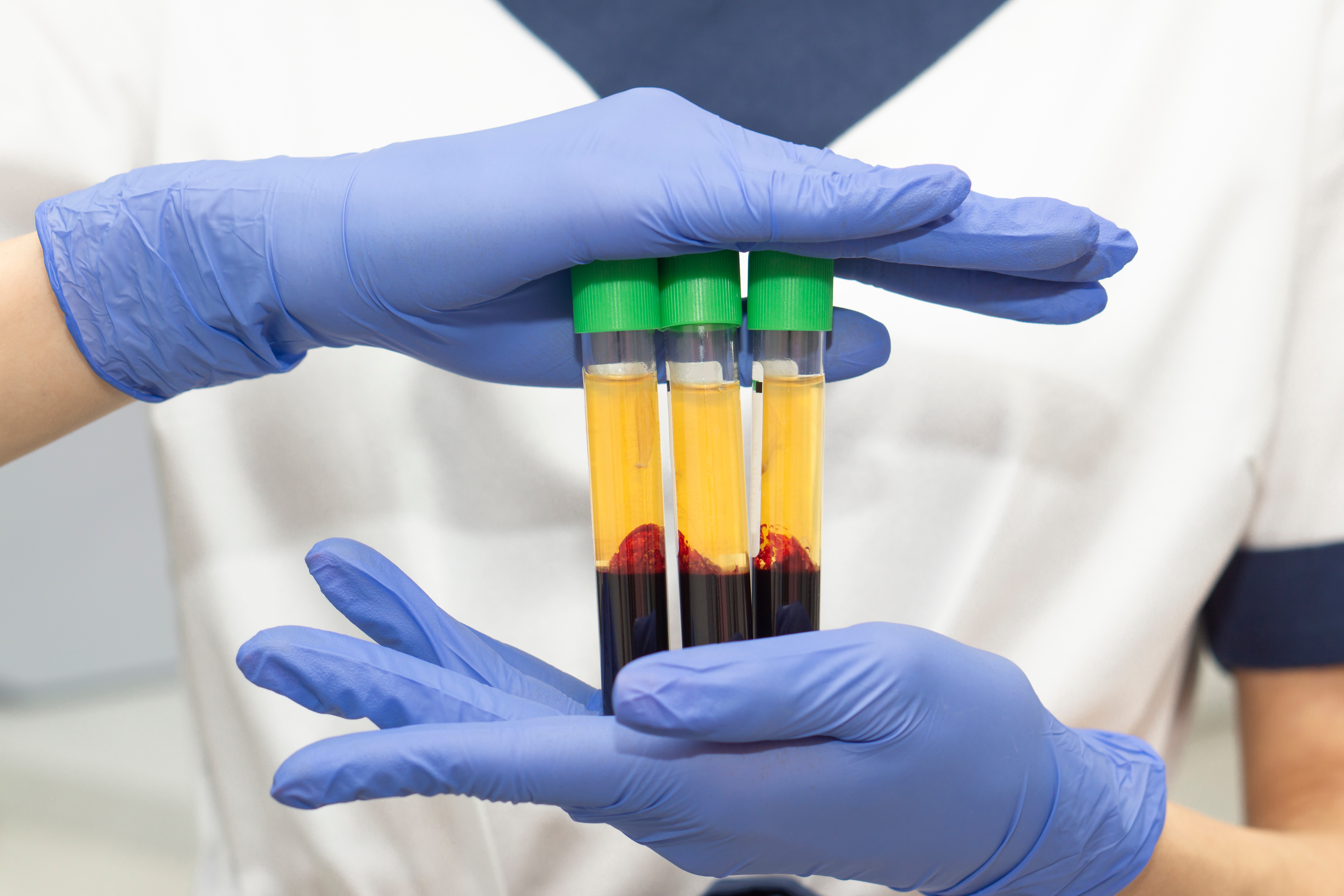 Close-up of woman holding vials of blood