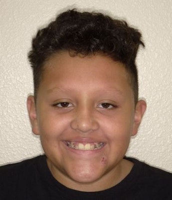 Patient Before Treatment from Dr. Hulme