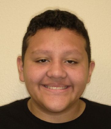 Patient After Treatment from Dr. Hulme