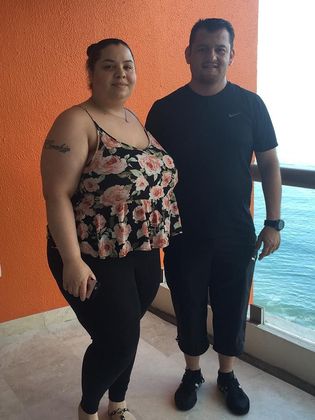 Before bariatric surgery