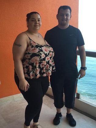 Before bariatric surgery