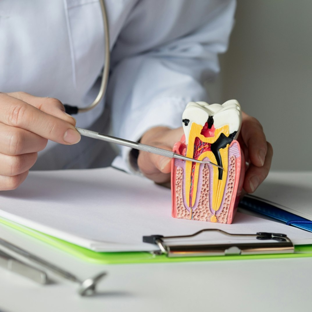a dentist pointing to a tooth model