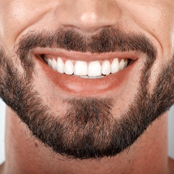 Close-up of white teeth