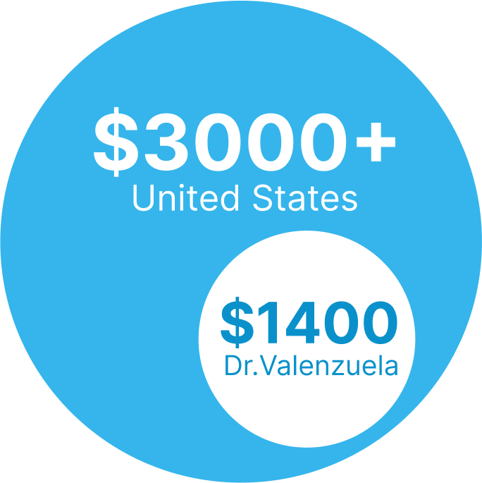 Implants in the US cost $3,000 and start at $1,400 with Dr. Valenzuela