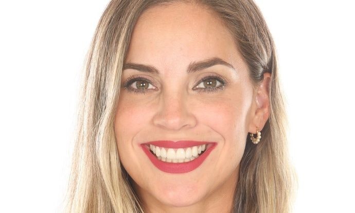 Dr. Valenzuela placed Lumineers to create a beautiful smile