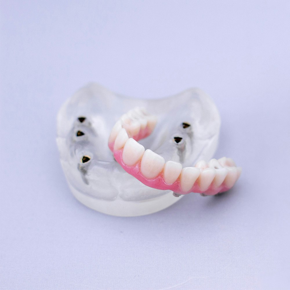 Denture implants
