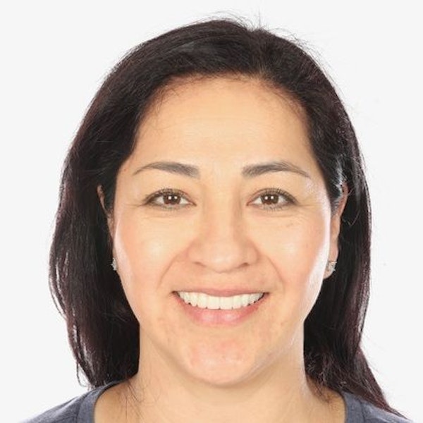 Dr. Jose Valenzuela's female patient after dentures