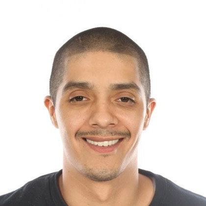 Dr. Jose Valenzuela's patient after tooth extraction