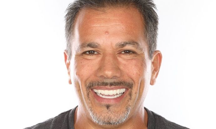 Dr. Jose Valenzuela's patient after All-on-4 dentures