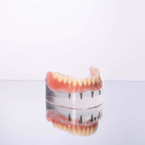 all-on-4 dentures on model
