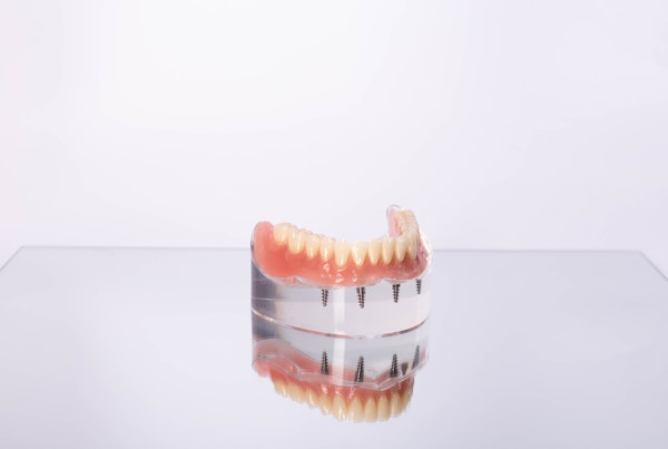 all-on-4 dentures on model