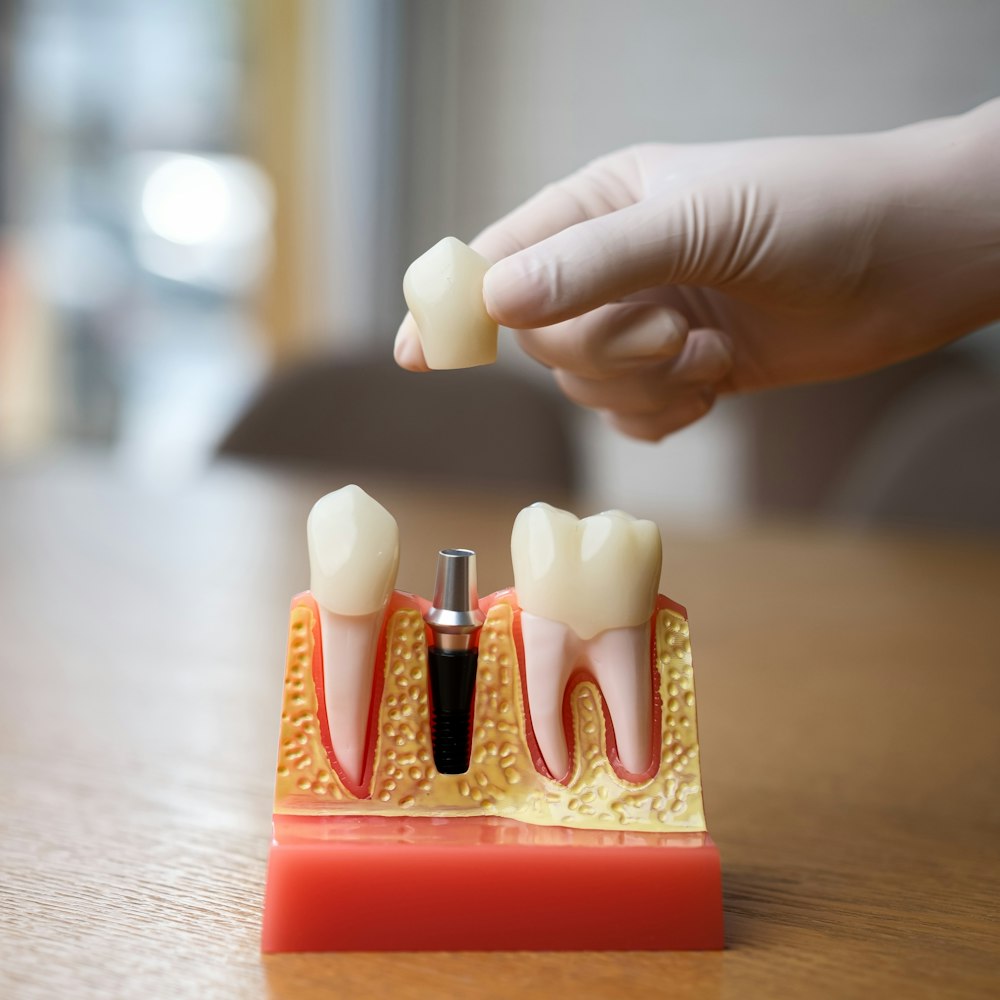 dental implant model