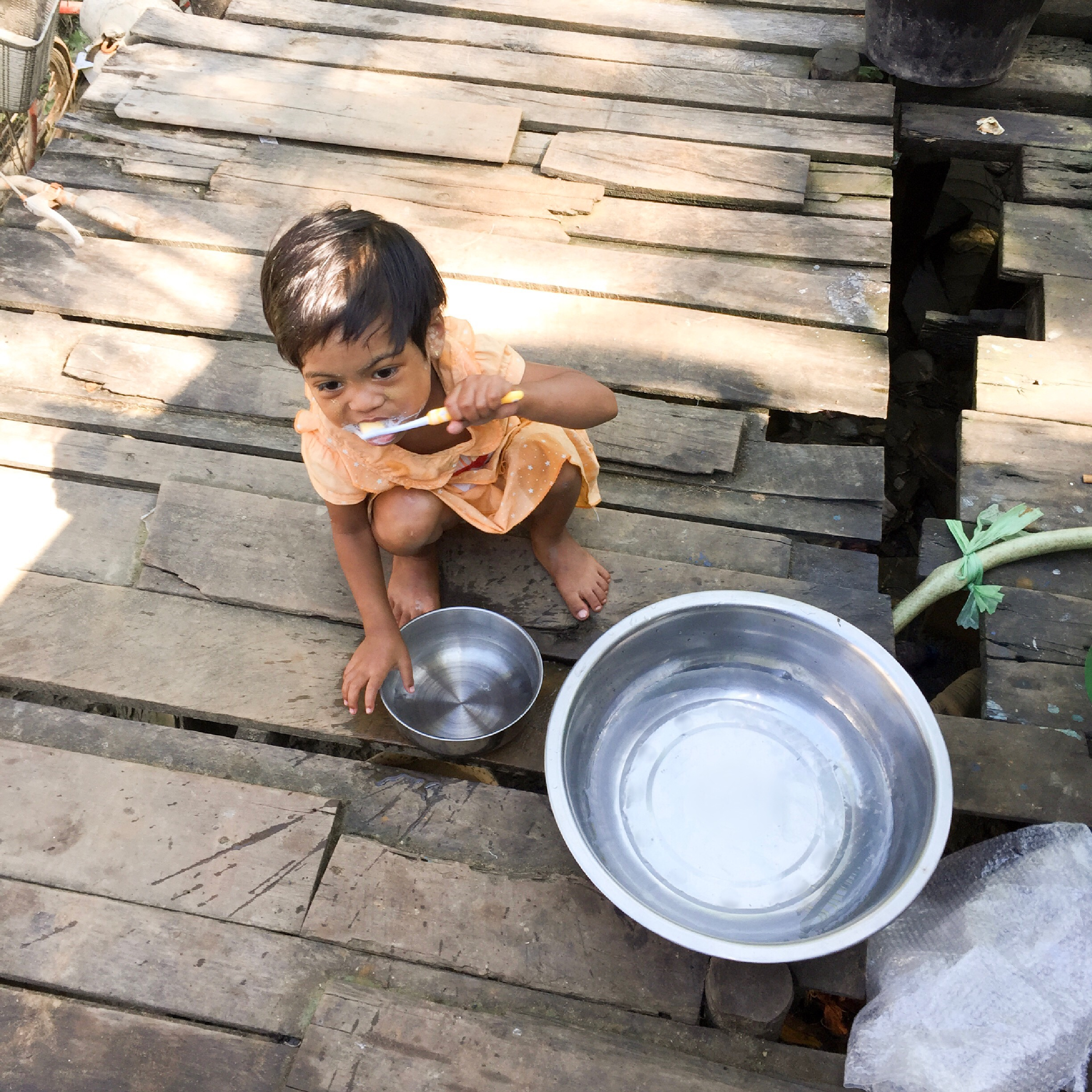 Child benefiting from international dental assistance program