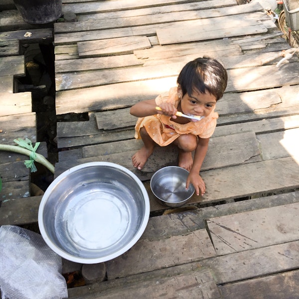 Child benefiting from international dental assistance program