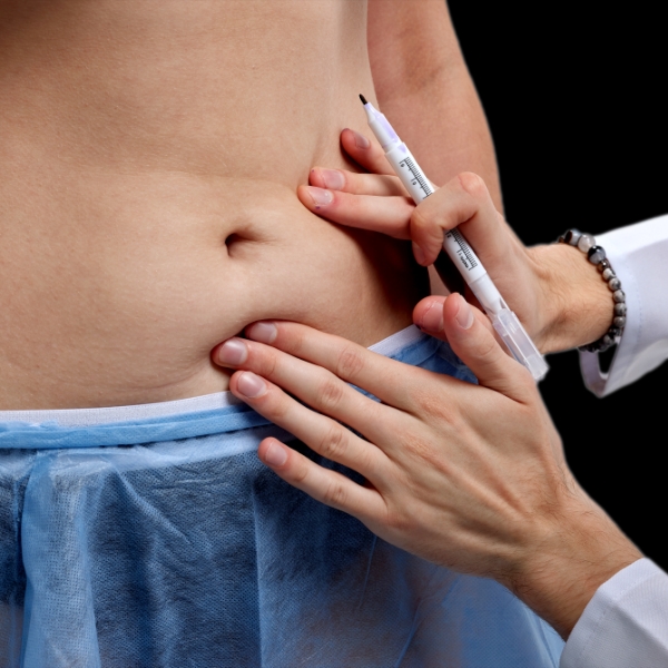 Doctor inspecting belly fat