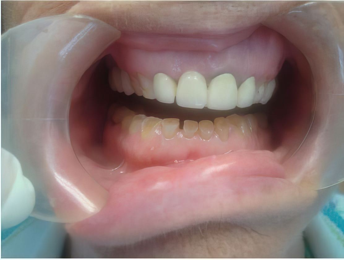 Case 3 before procedure